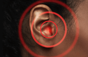 How Upper Cervical Care can Help