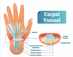 The Upper Cervical Connection