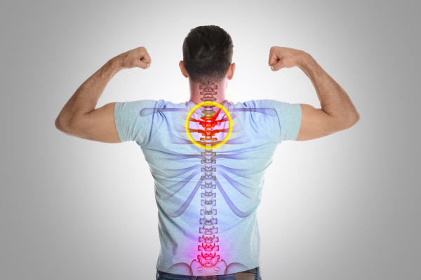Cape Girardeau back pain